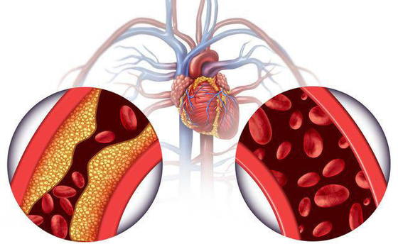 Asma çayından OEM özel etiket dihidromirisetin Asma Çay Ekstresi dihidromirisetin tozu 98%